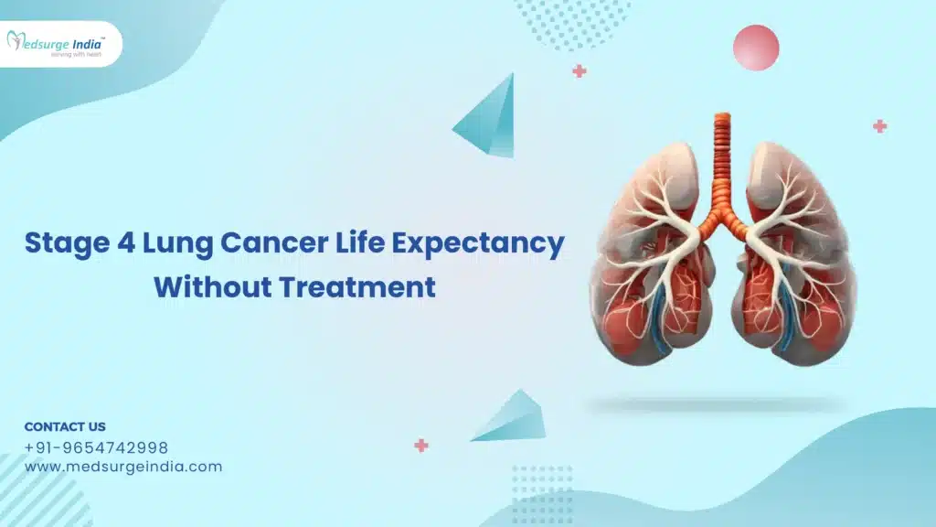 Stage Lung Cancer Life Expectancy Without Treatment Medsurge India