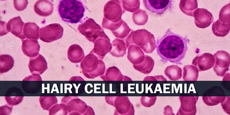 Hairy Cell Leukemia Treatment Price in India Best