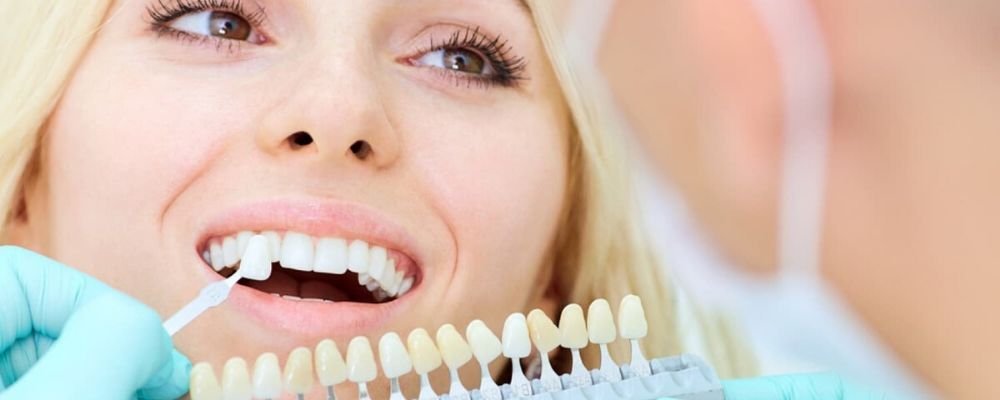 teeth whitening cost in india