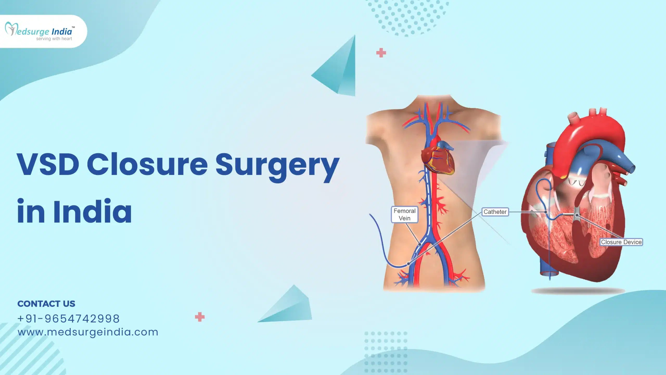 VSD Closure Surgery Cost in India