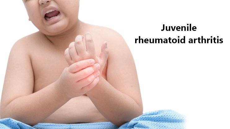 juvenile rheumatoid arthritis treatment in india