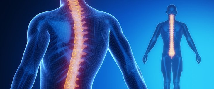 Scoliosis Spine Surgery Cost in India