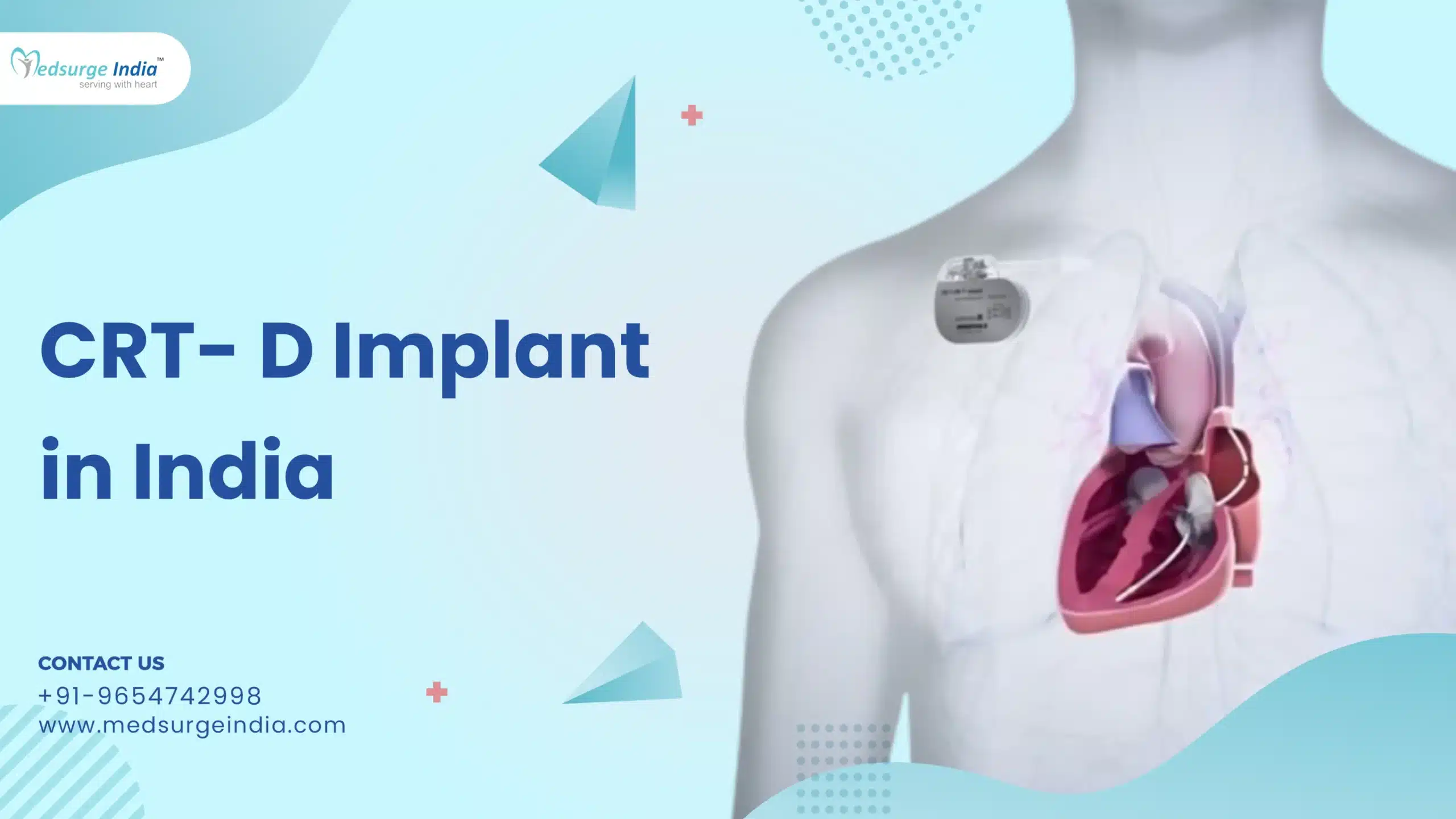 CRT- D Implant (Cardiac Resynchronization Therapy) Cost in India
