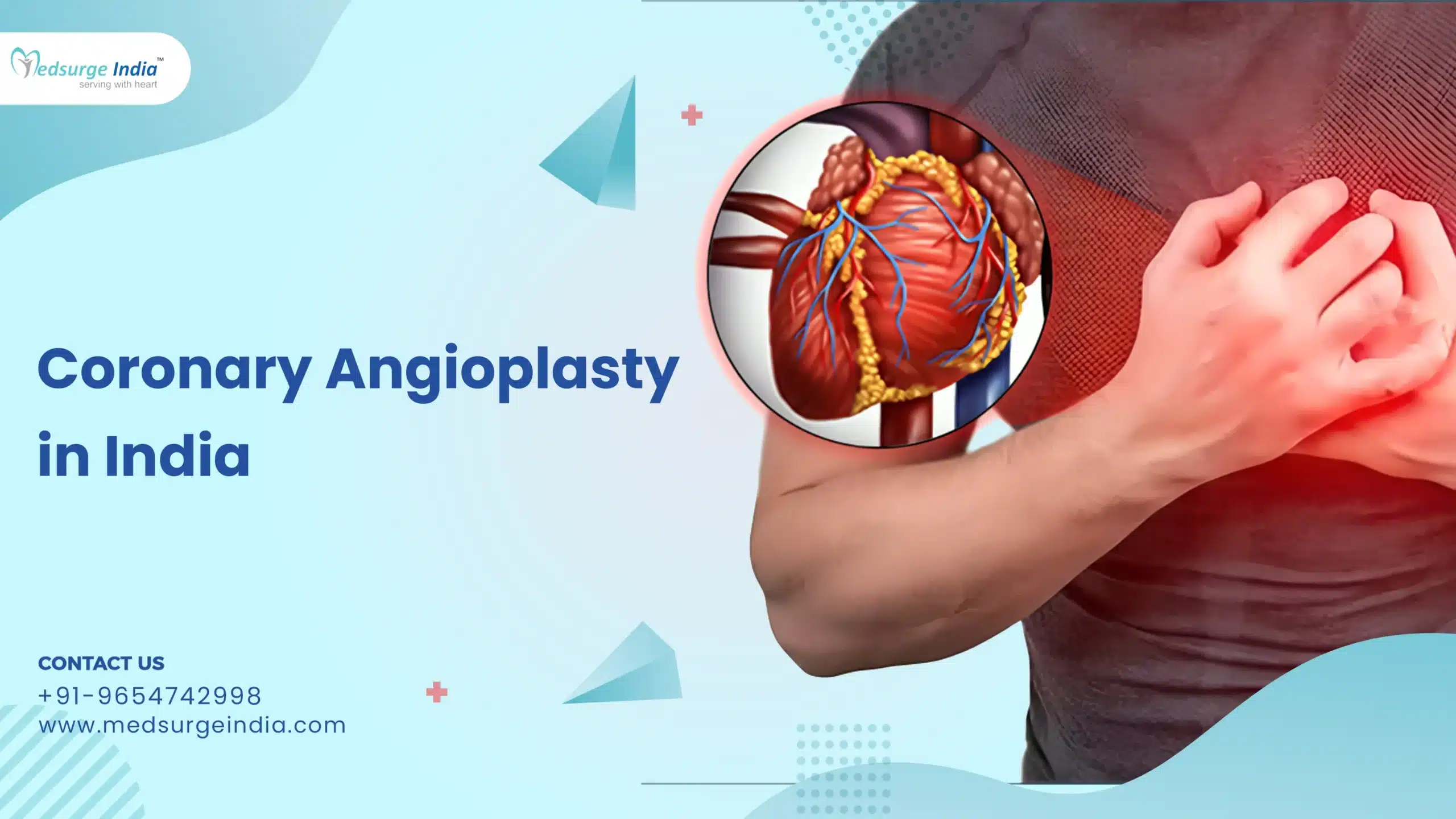 Coronary Angioplasty Cost in India