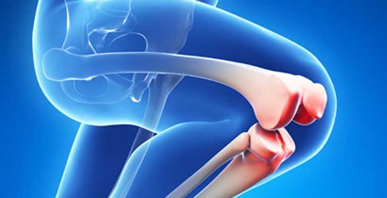 How long does it take to recover from Knee Replacement Surgery?