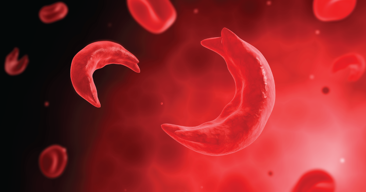 Symptoms Of Sickle Cell Anemia Child