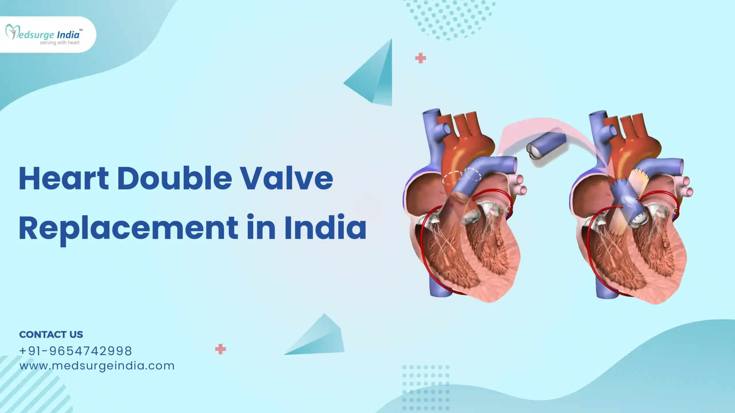 Heart Double Valve Replacement Cost in India