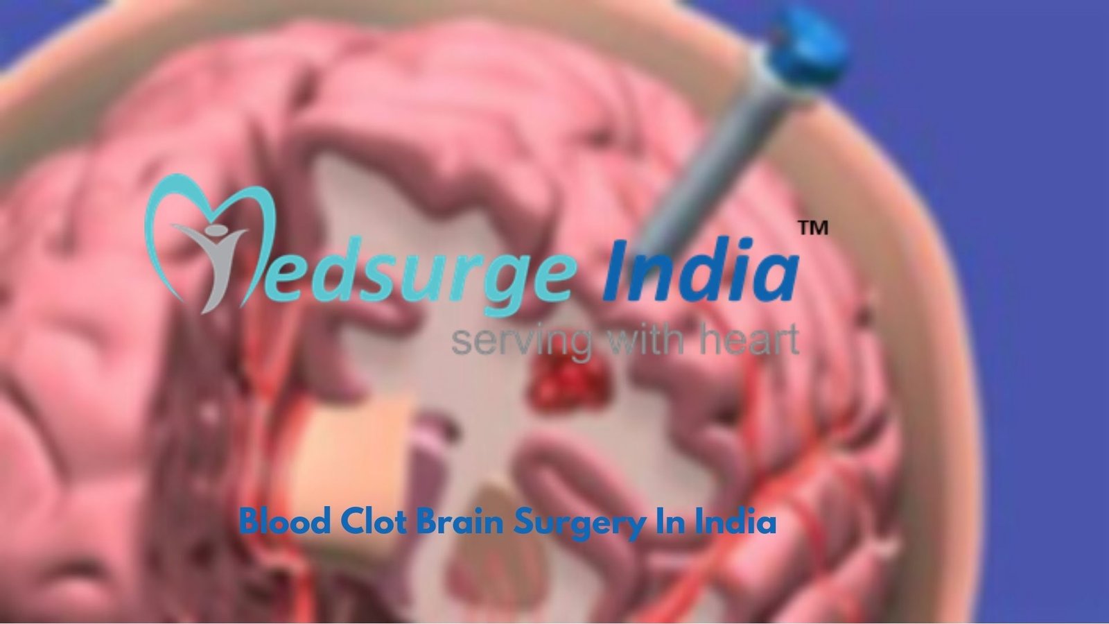 Blood Clot Treatment In India- Contact Medsurge India Now