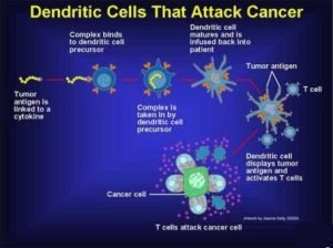 Dendritic Cell Therapy Helps in Cancer Treatment