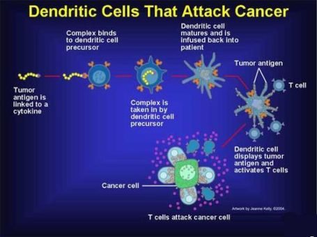 How Dendritic Cell Therapy Helps in Cancer Treatment ?