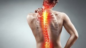 scoliosis surgery information