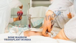 bone marrow transplant in india