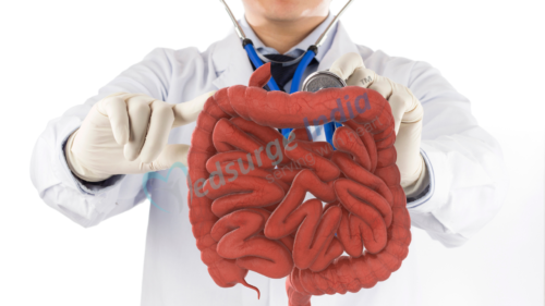 Know All About Small Intestine Transplant