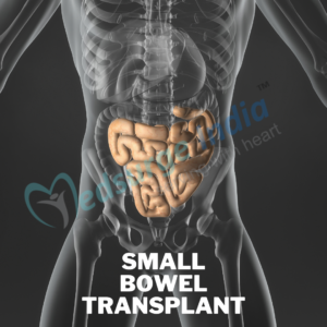 small bowel transplant in india