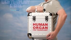 Lung Transplant Procedure in India