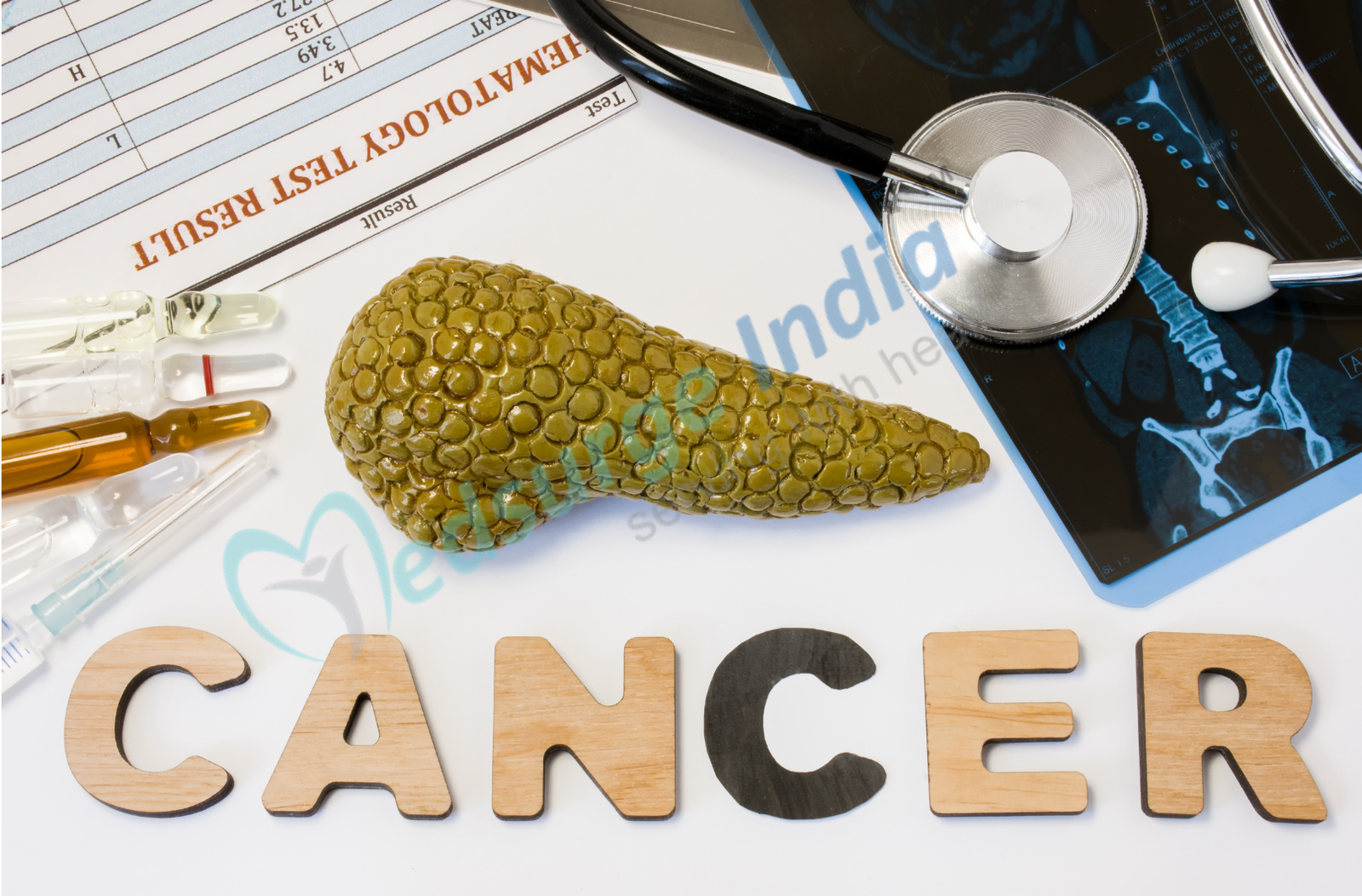 Know Everything About Pancreatic Cancer Treatment in India