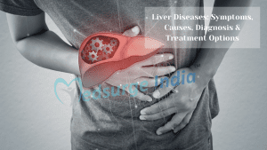 Liver Diseases: Symptoms, Causes, Diagnosis, and Treatment
