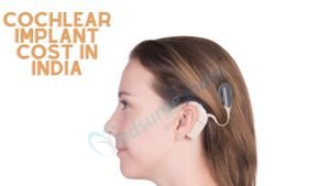 Cochlear Implant cost in India