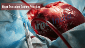 Heart Transplant Surgery |