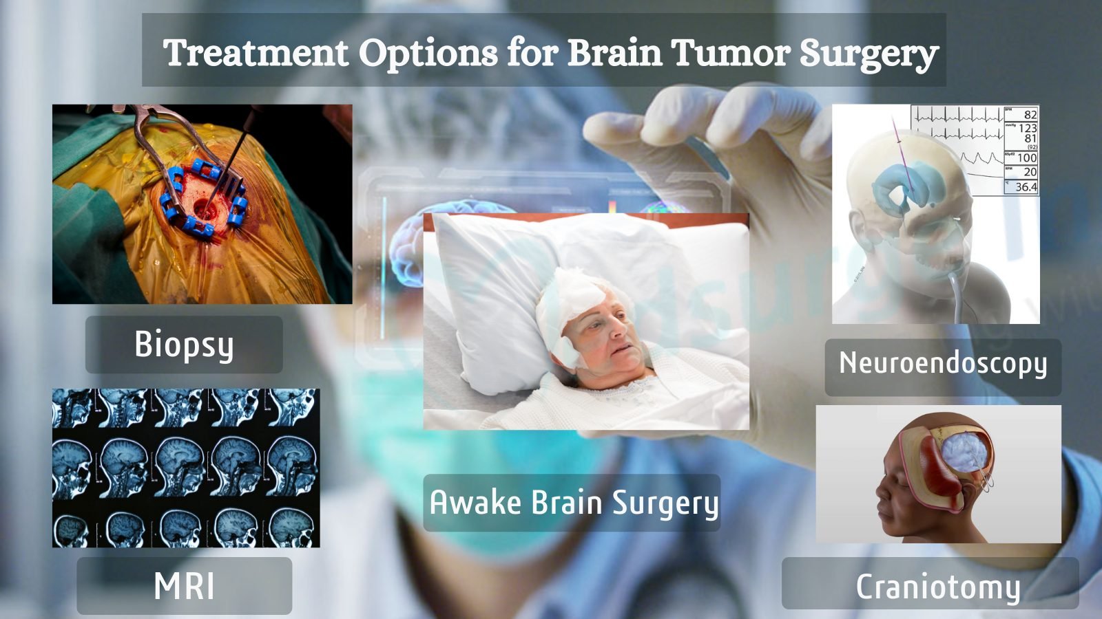 Brain Tumour Surgery types