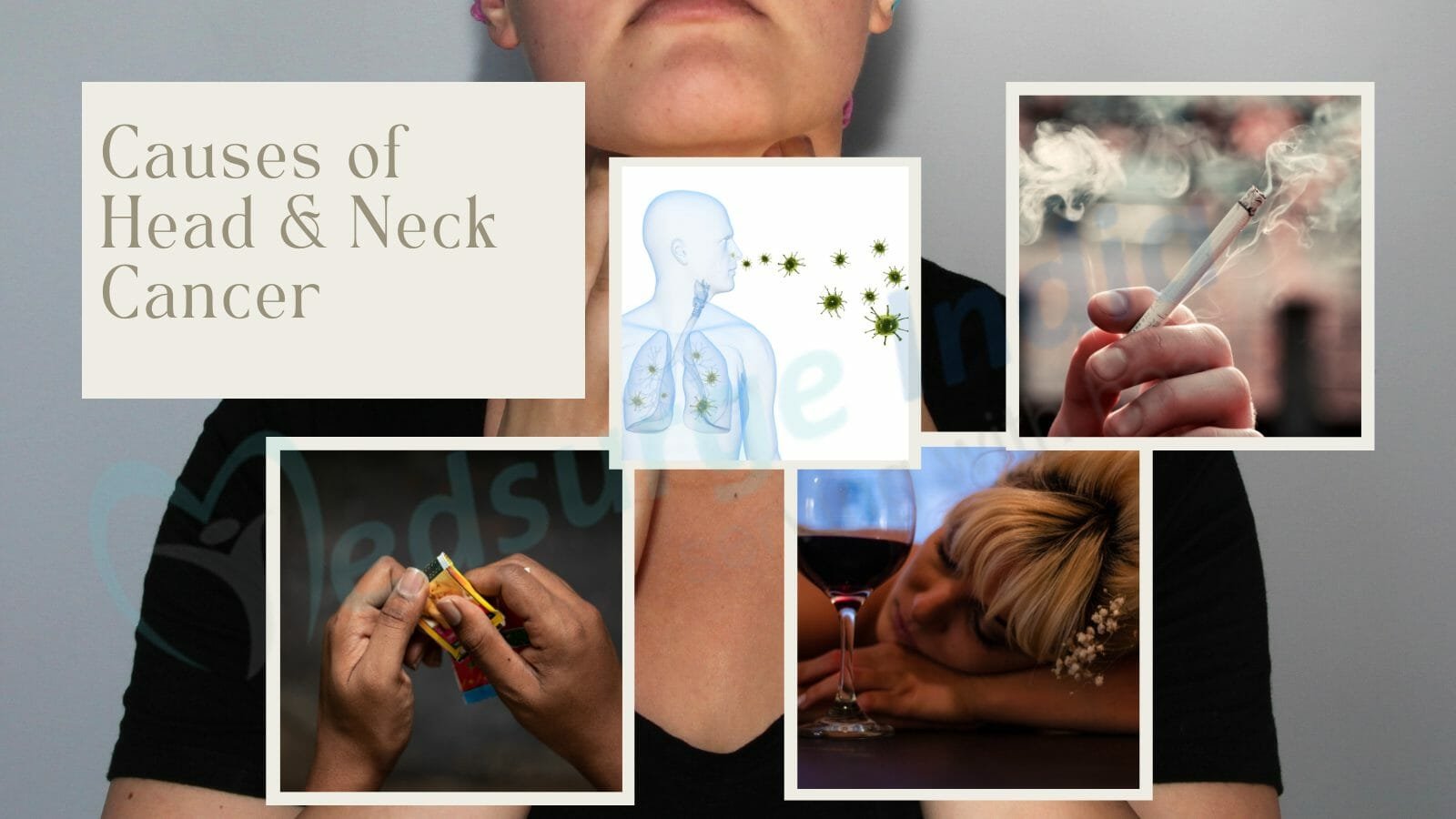 Causes of Head and Neck Cancer