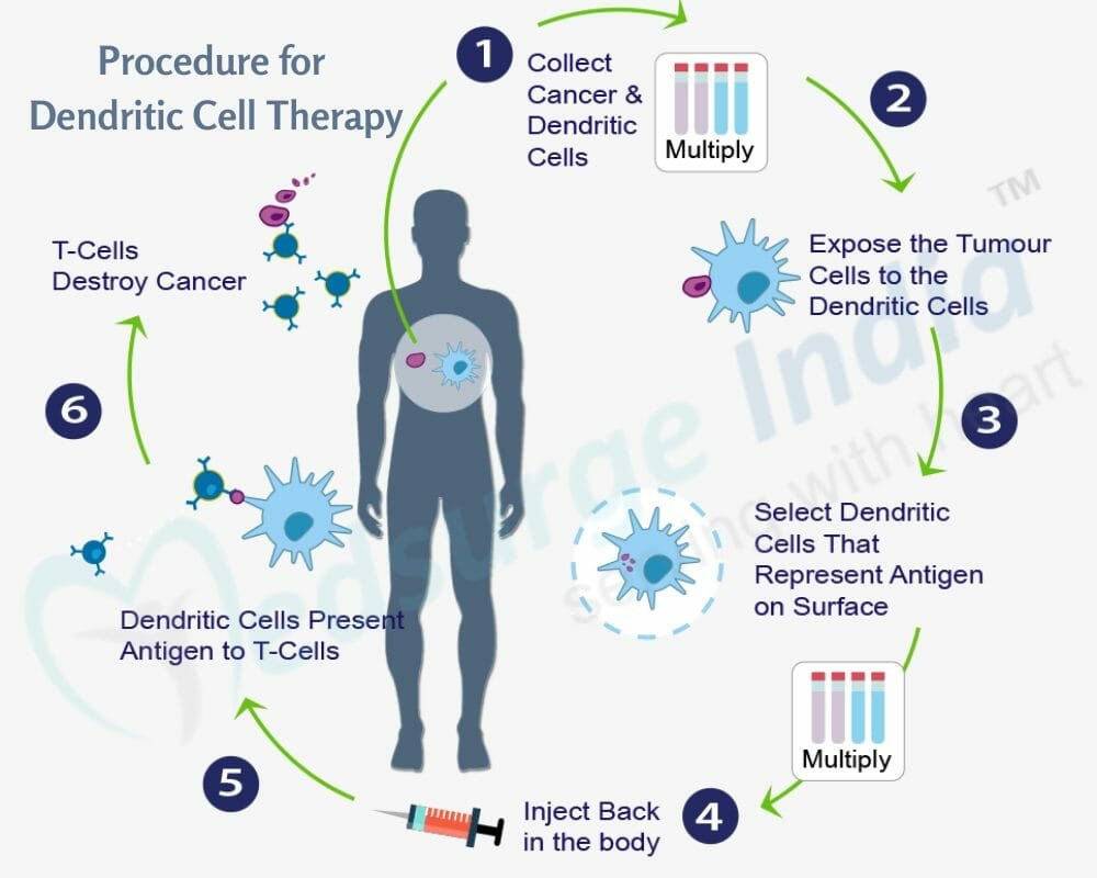 Procedure for Dendritic Cell Therapy