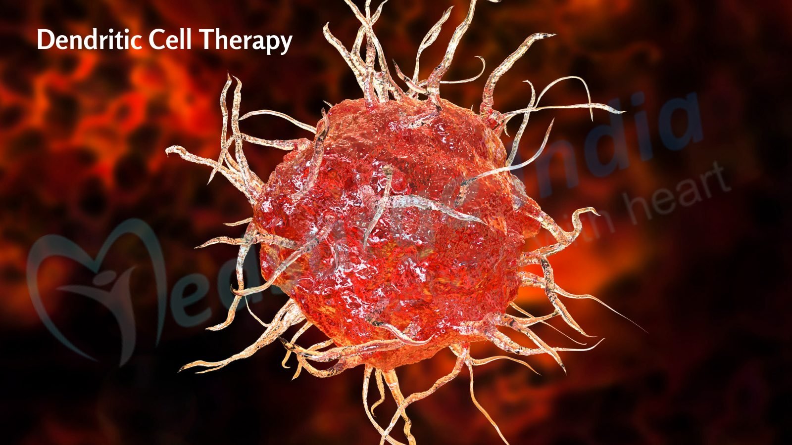 Cost of Dendritic Cell Therapy in India