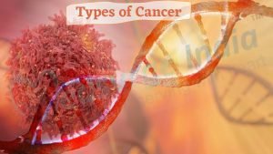 types of cancer