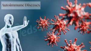 Autoimmune Disease