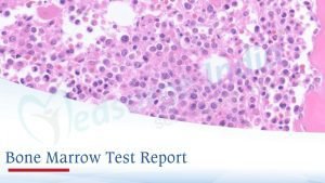 Bone Marrow Test Report
