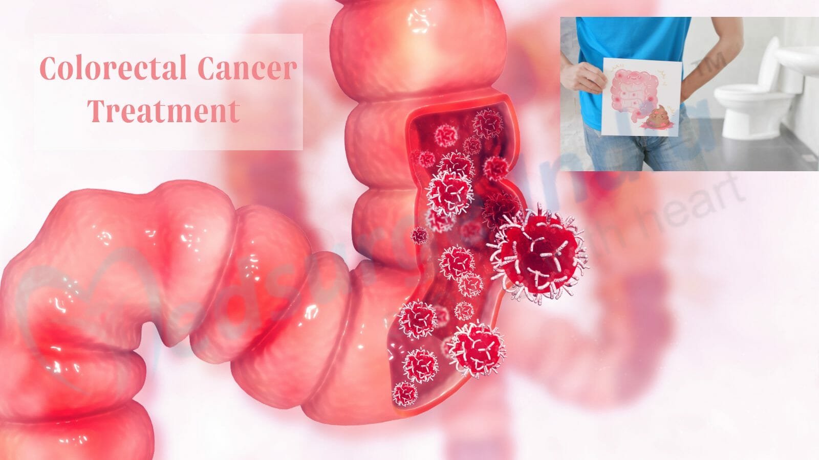 Colorectal Cancer Treatment Cost in India
