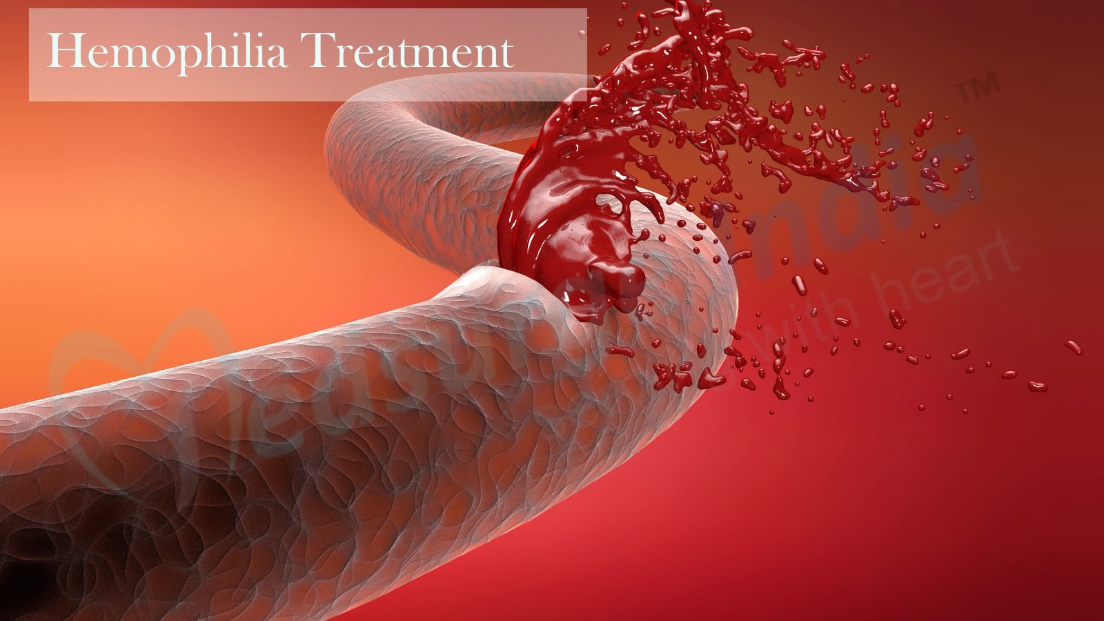 Hemophilia Treatment Cost In India Types And Diagnosis Medsurge India 2840