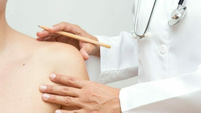 Skin cancer Treatment in India