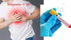 Troponin-Test.