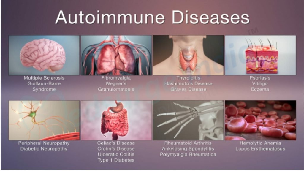 Types of autoimmune diseases
