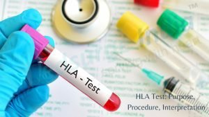 HLA Test: Purpose, Procedure, Interpretation HLA Test