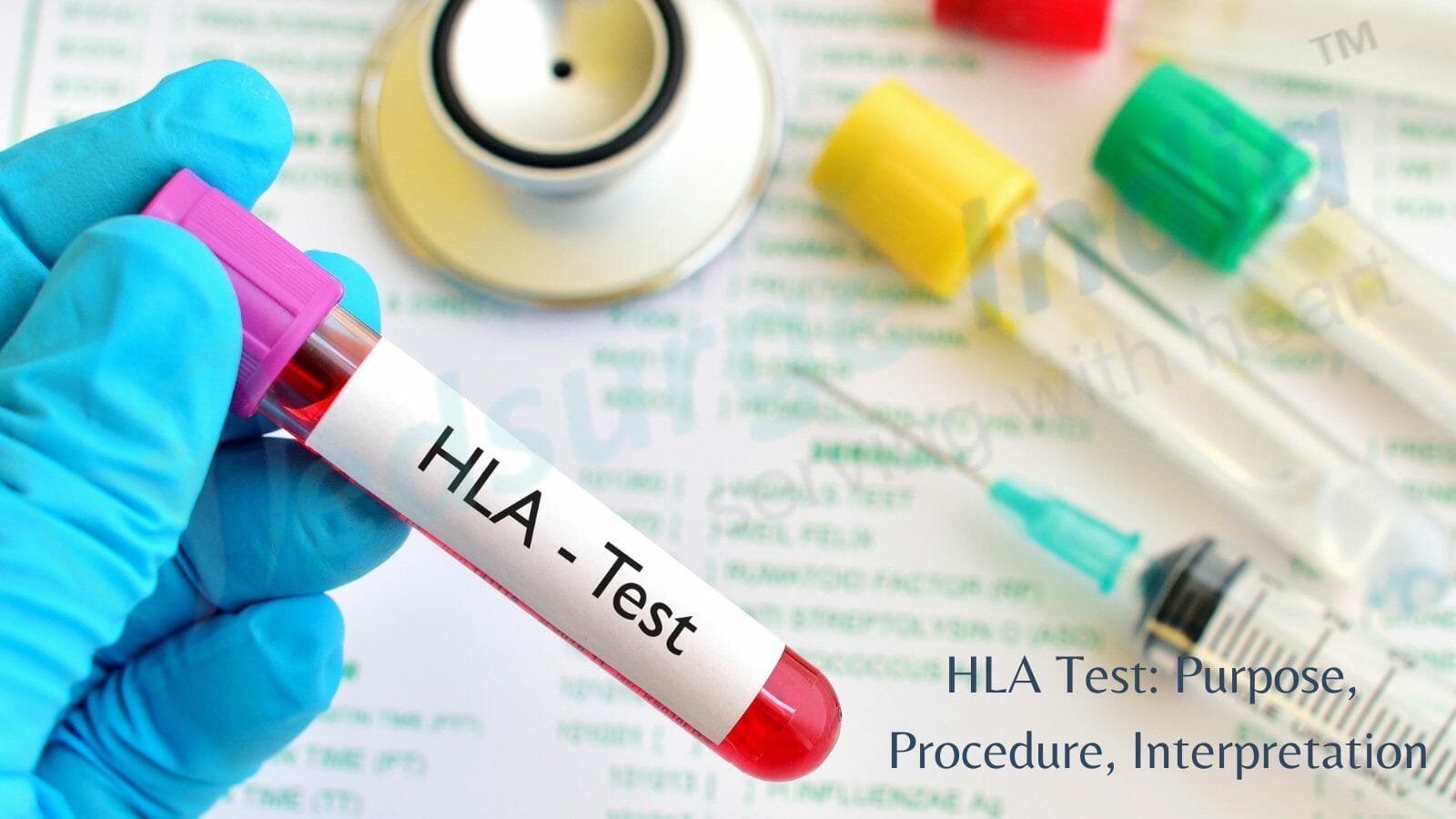 HLA Test: Purpose, Procedure, Interpretation