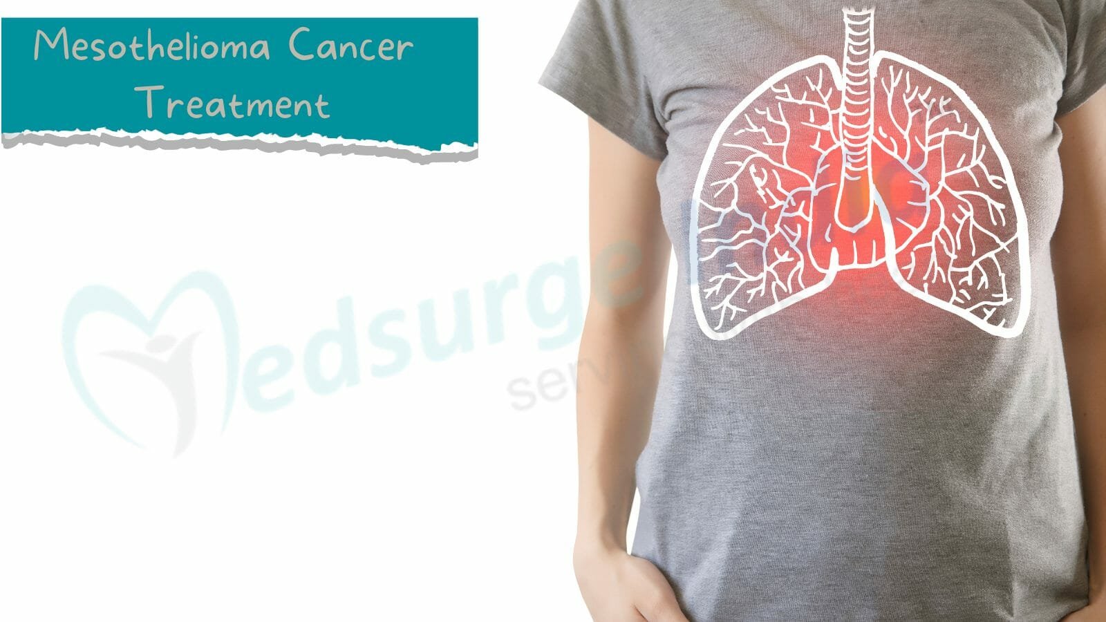 Mesothelioma Cancer Treatment Cost in India