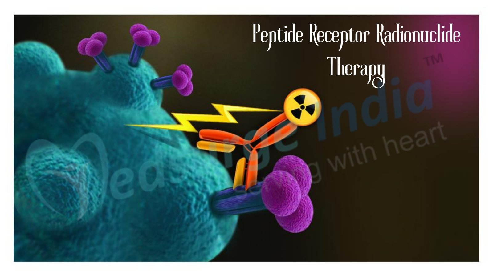 PRRT Therapy Cost in India