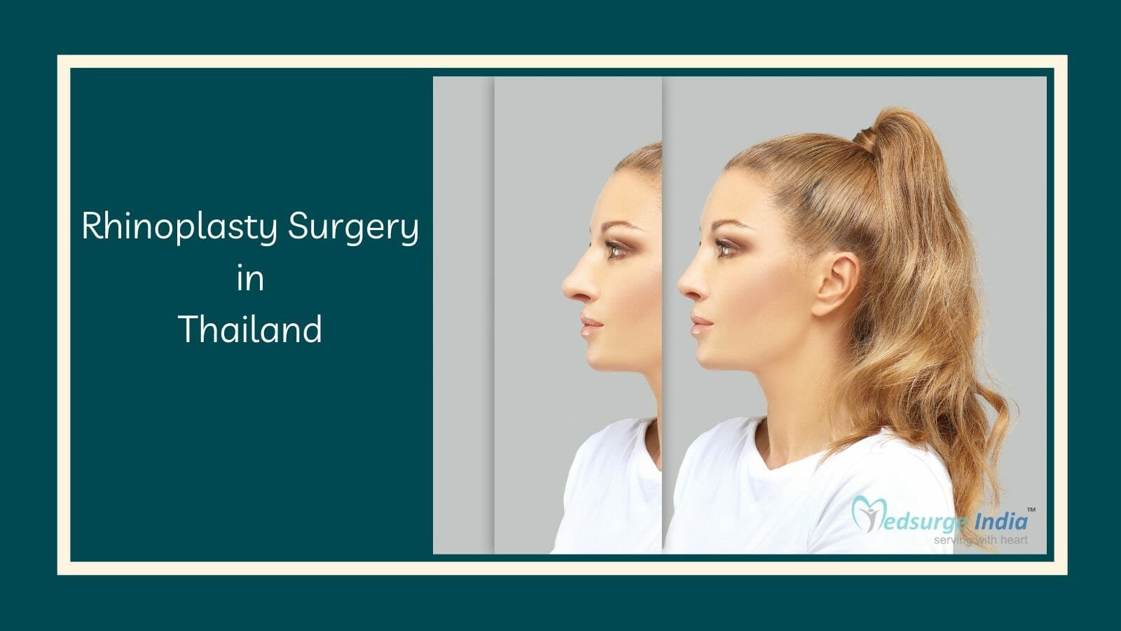 Rhinoplasty Surgery Cost In Thailand