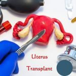 Uterus Transplant in India