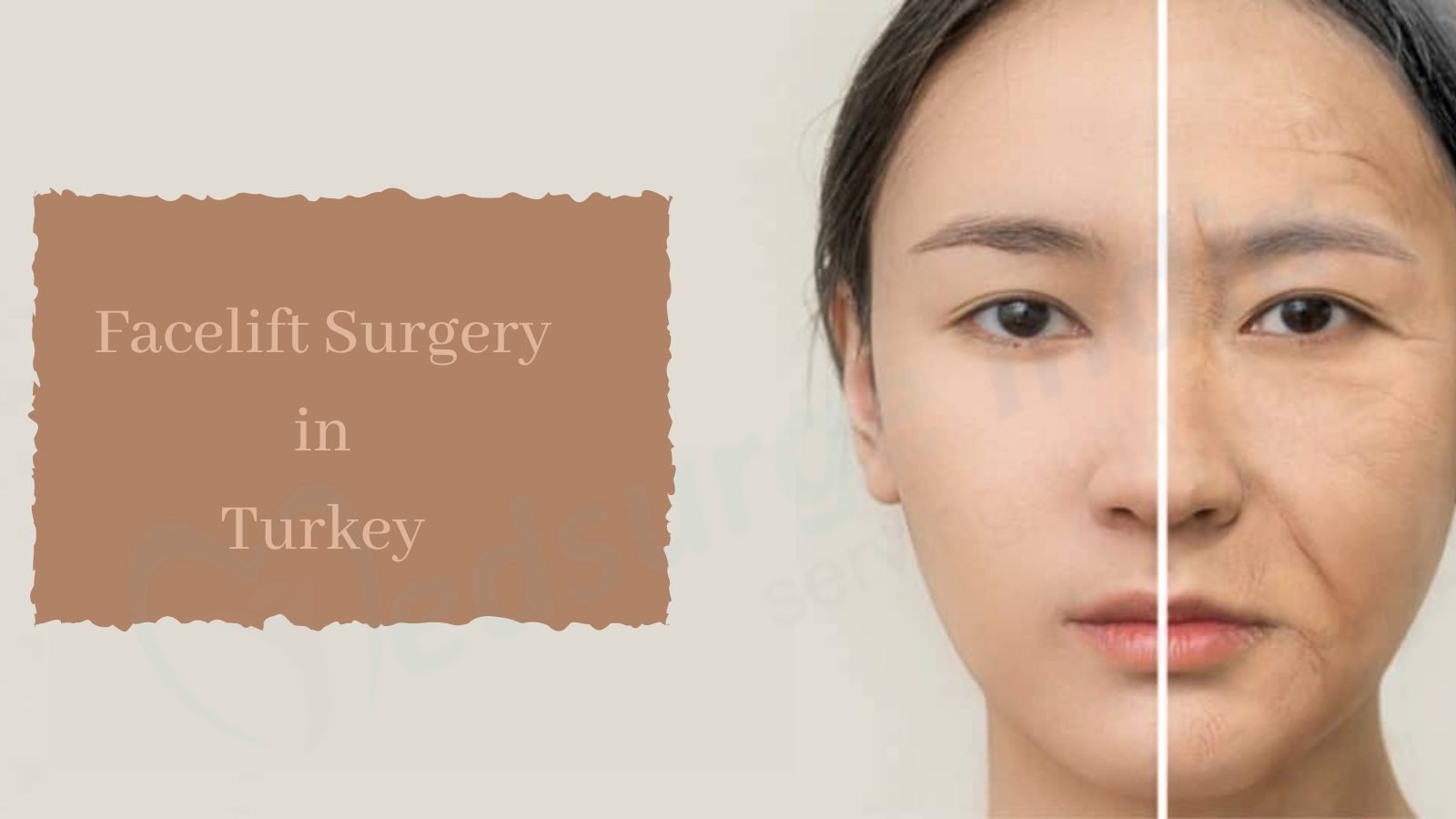 Facelift Surgery Cost in Turkey