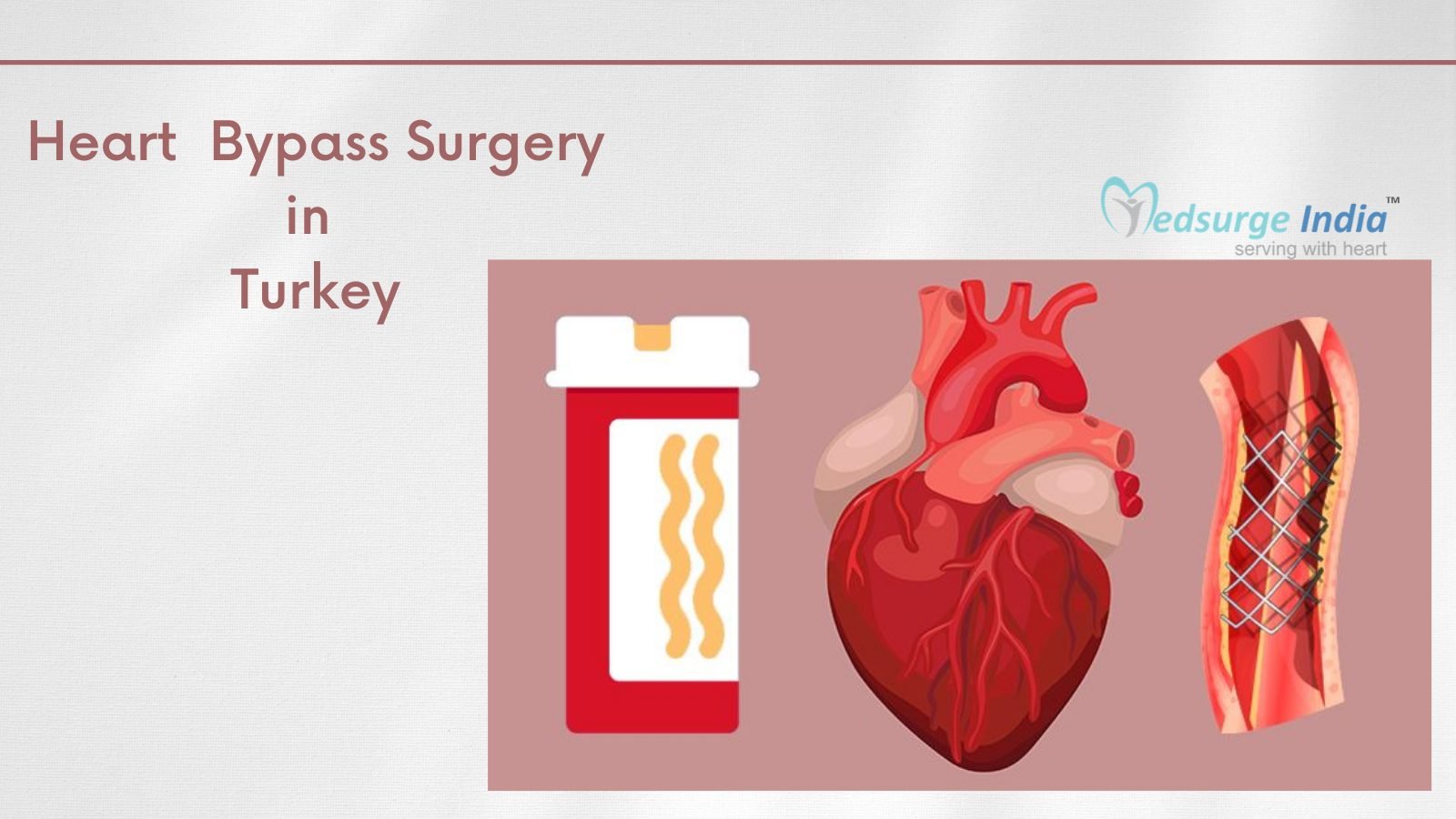 Heart Bypass Surgery Cost In Turkey | Procedure & Hospitals | Medsurge ...