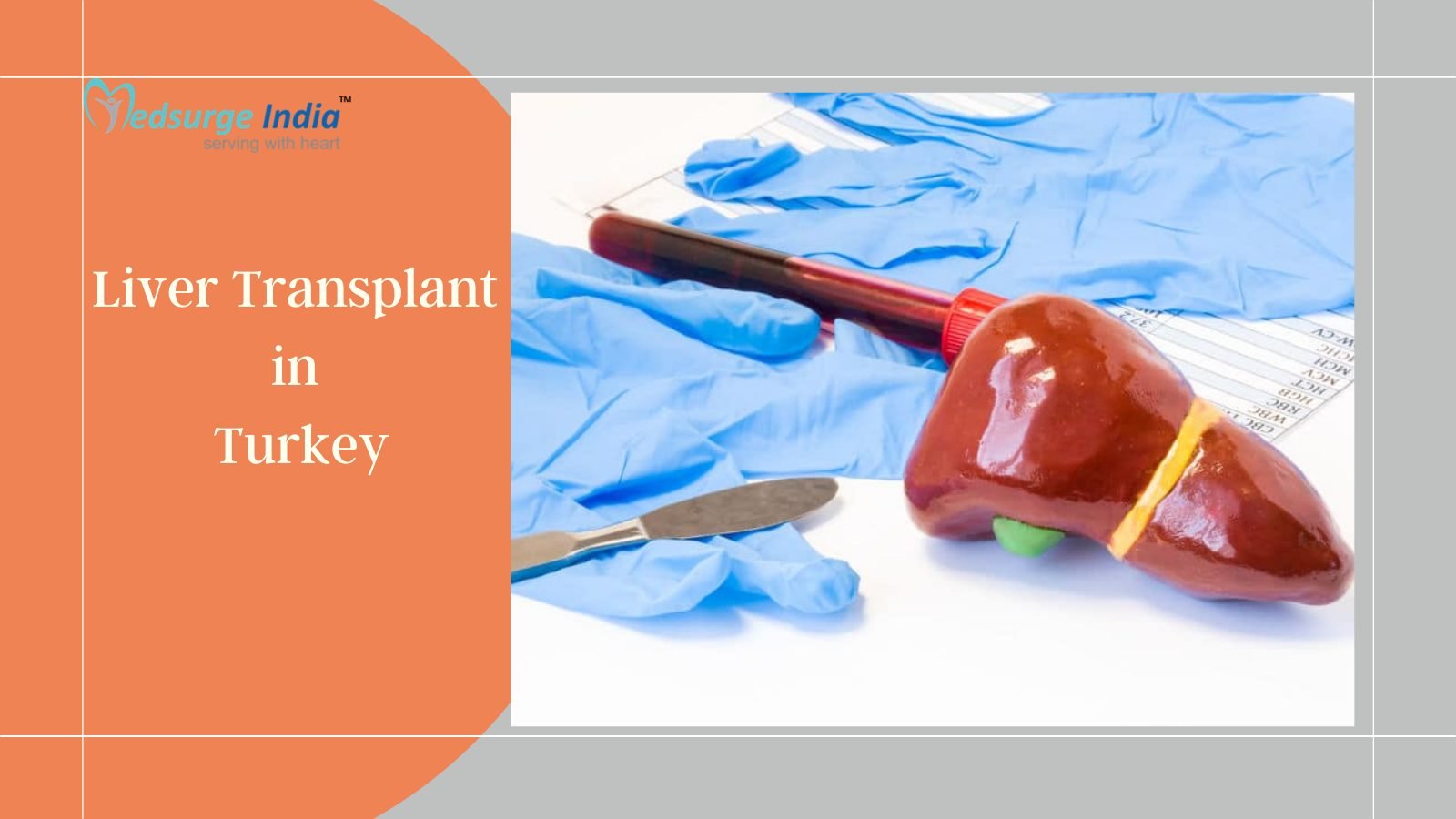 Liver Transplant Cost in Turkey