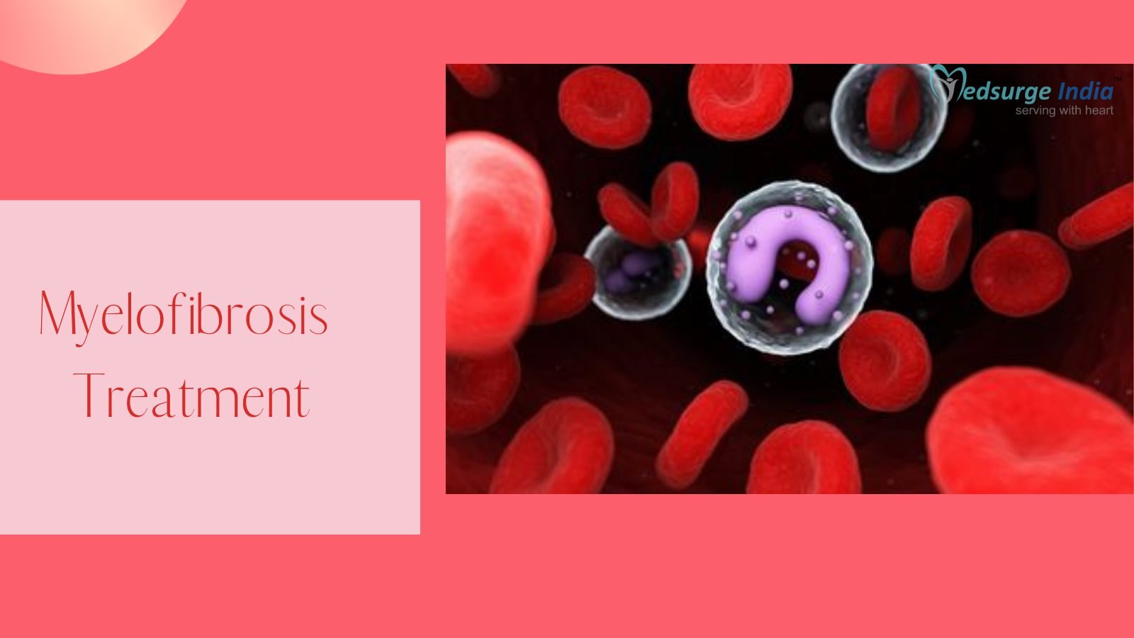 Myelofibrosis Treatment Cost In India | Procedure & Hospitals ...