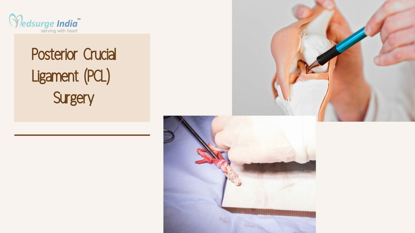 Posterior Crucial Ligament (PCL) Surgery Cost in India