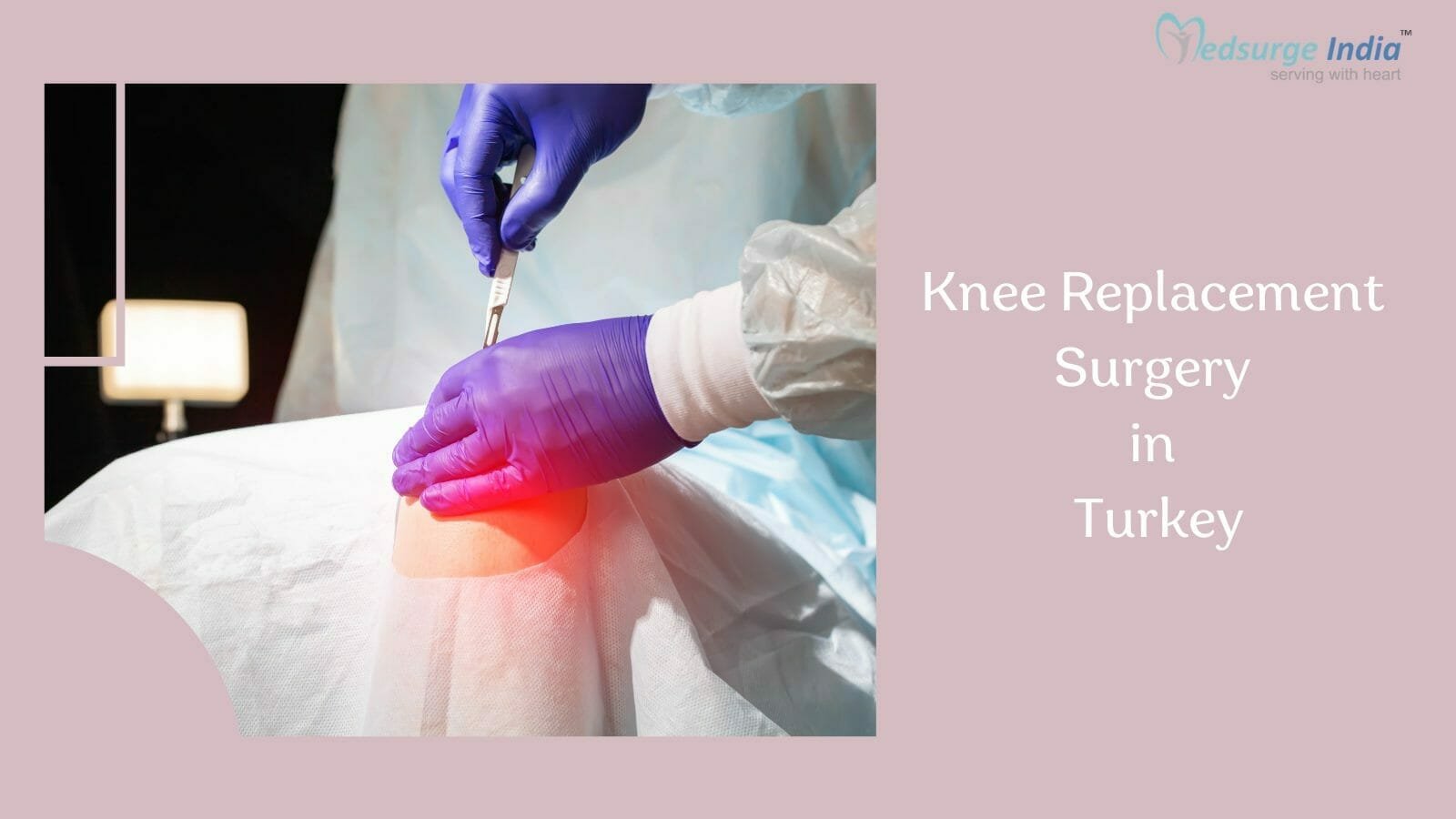 Knee Replacement Surgery Cost In Turkey