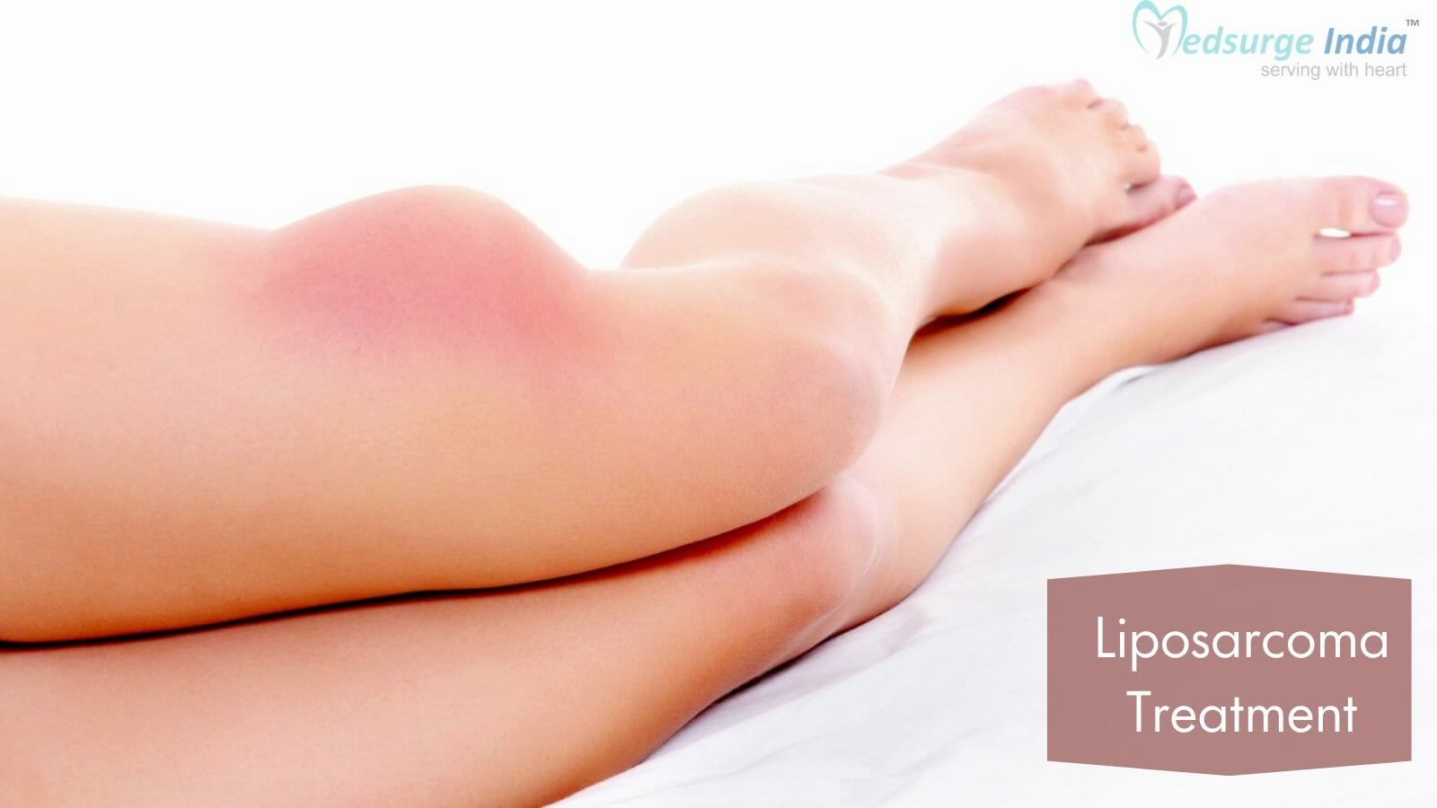 Liposarcoma Treatment Cost in India