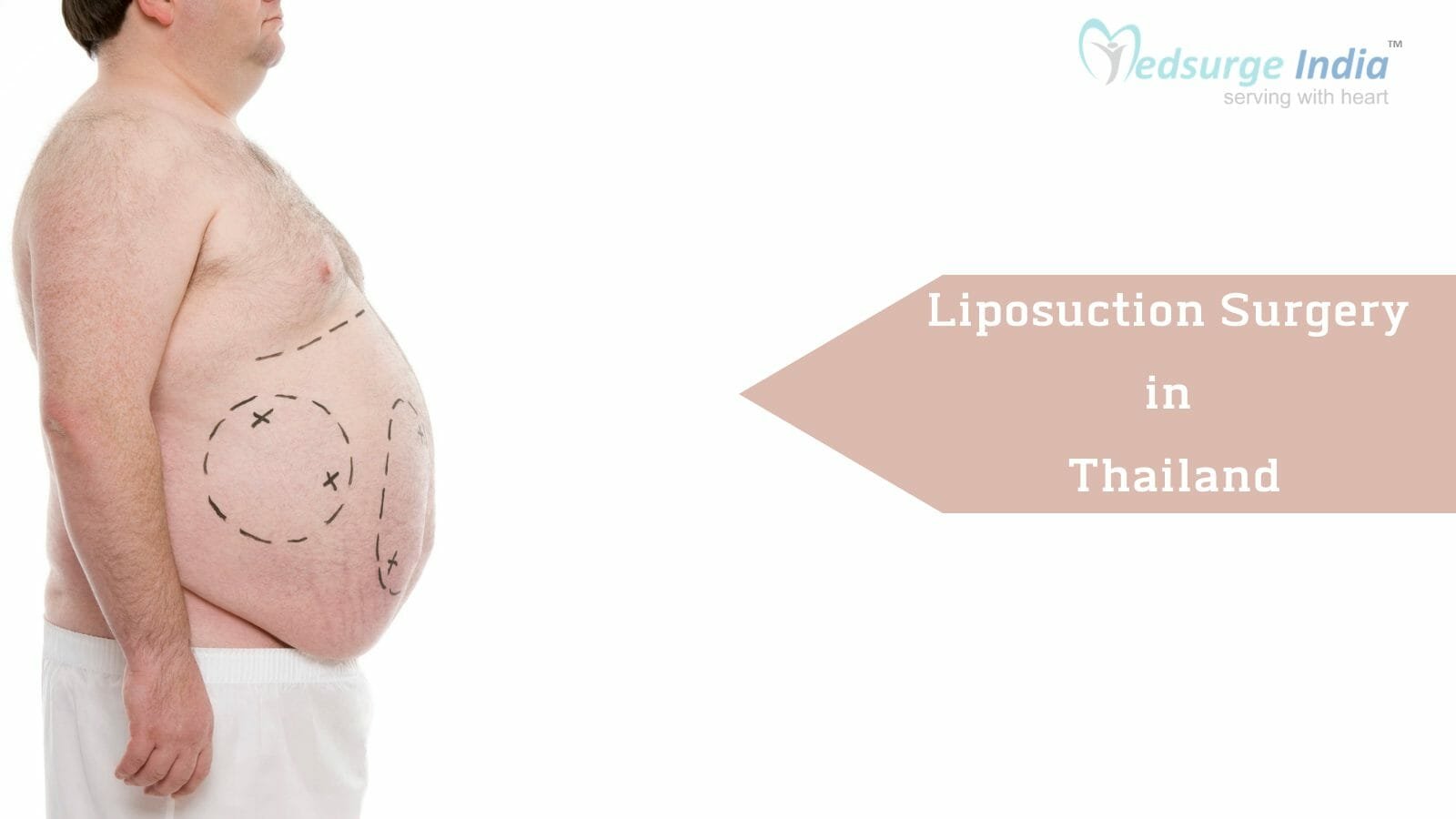 Liposuction Surgery Cost in Thailand