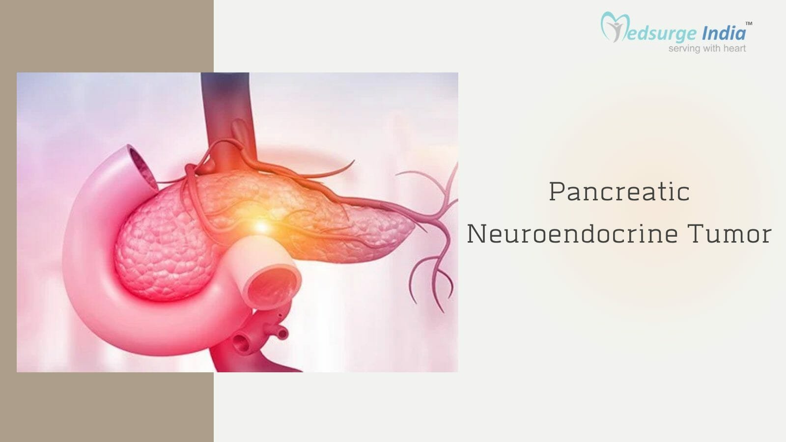 Pancreatic Neuroendocrine Tumor Treatment Cost In India